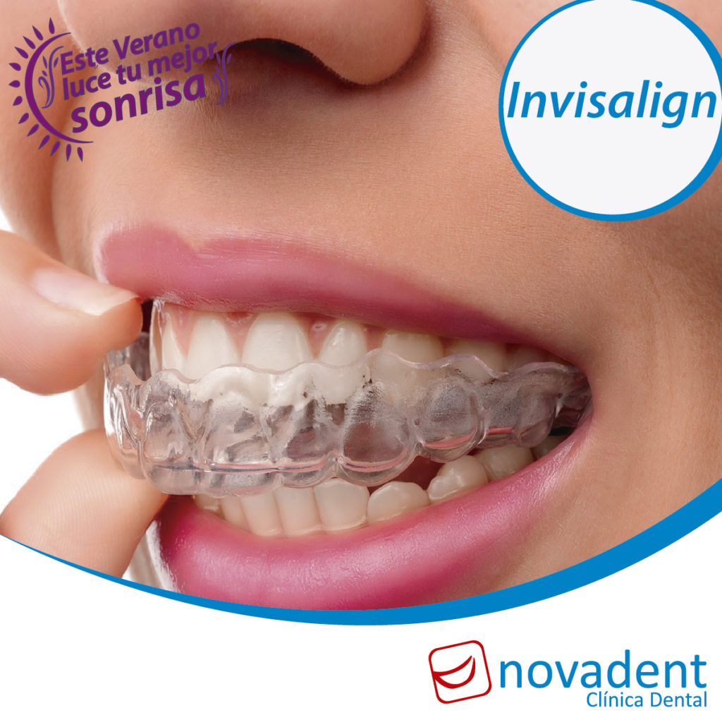 Invisalign